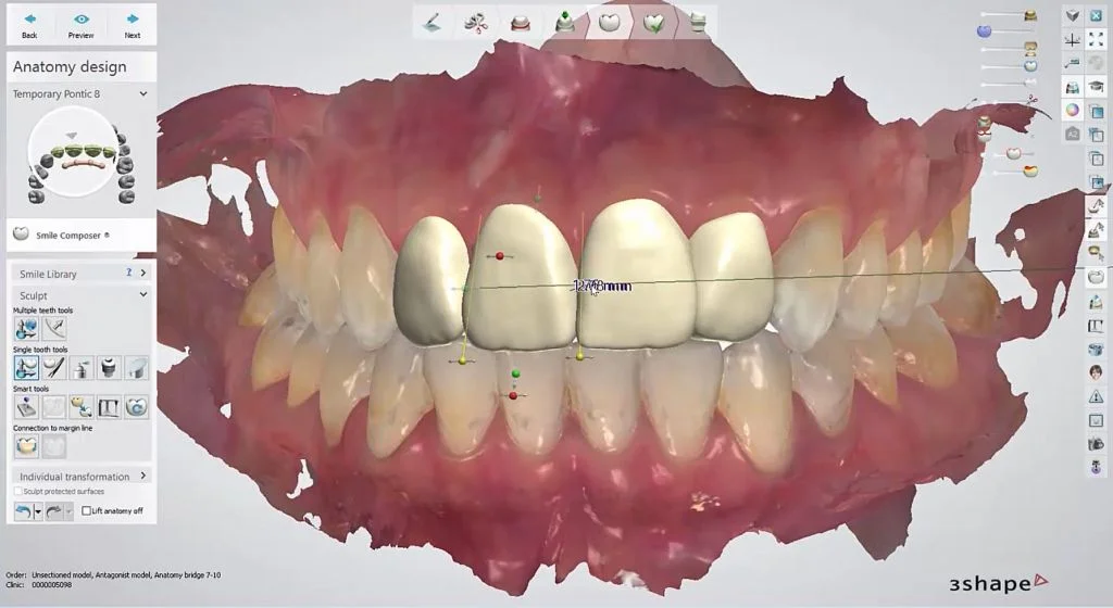 цифровой smile design (DSD)