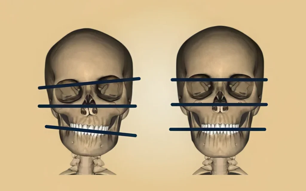 симметрия лица